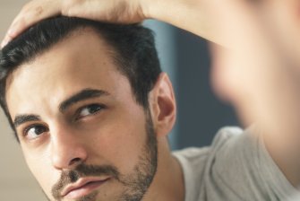 Caída del cabello: alopecia areata, epidemiología y etiopatogenia