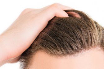Caída del cabello, ¿cómo evitarlo?